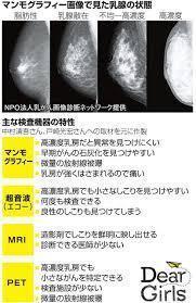 マンモグラフィーとエコー検査.jpg